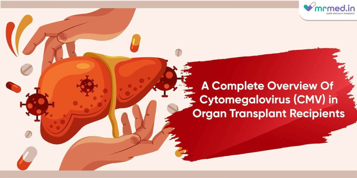A Complete Overview Of Cytomegalovirus (CMV) in Organ Transplant Recipients
