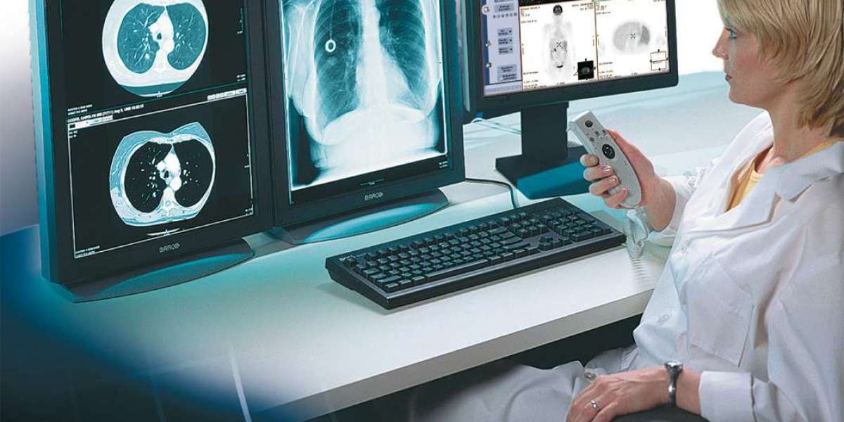 Teleradiology Market Key Industry Segments Poised for Strong Growth in Future 2033