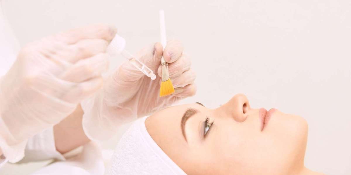 Understanding the Different Types of Chemical Peels Available in Dubai