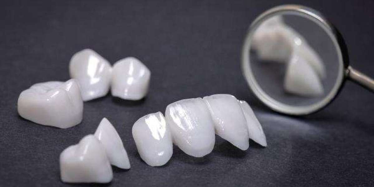 A Comprehensive Guide to Zirconia Ceramic Crowns in the UK