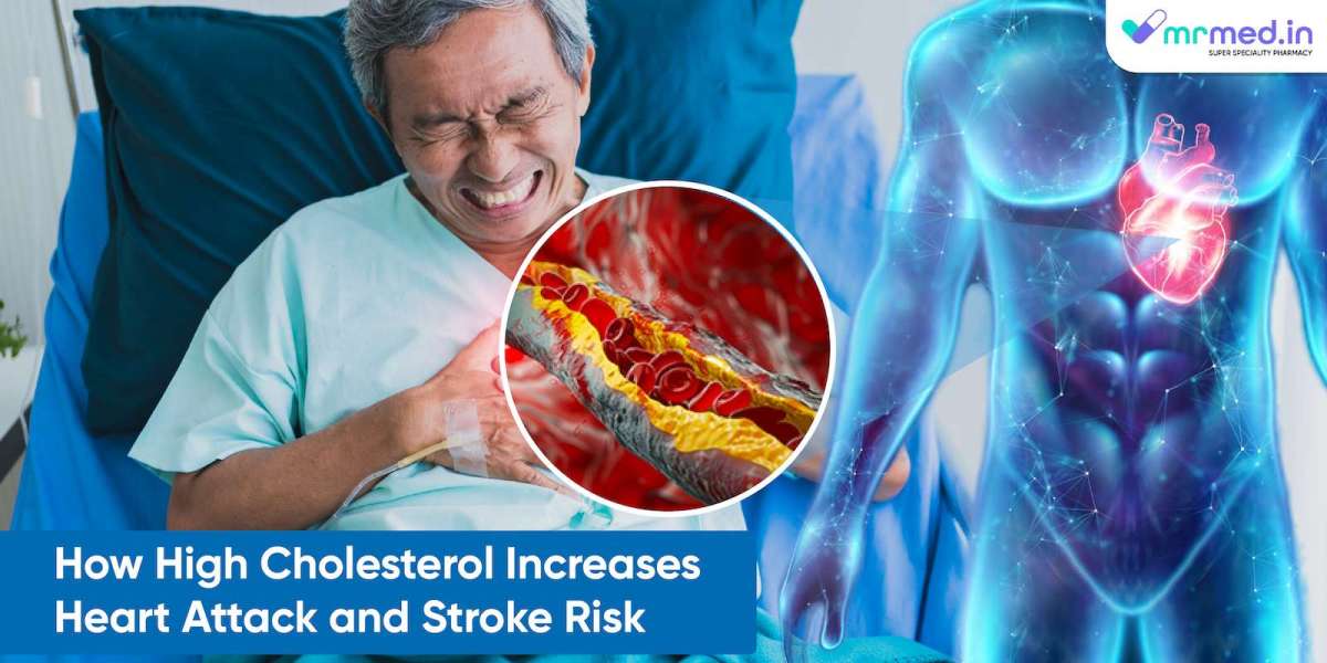 How High Cholesterol Increases Heart Attack and Stroke Risk